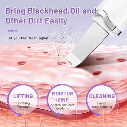 Electric Skin Scrubber Peeling Blackhead Remover