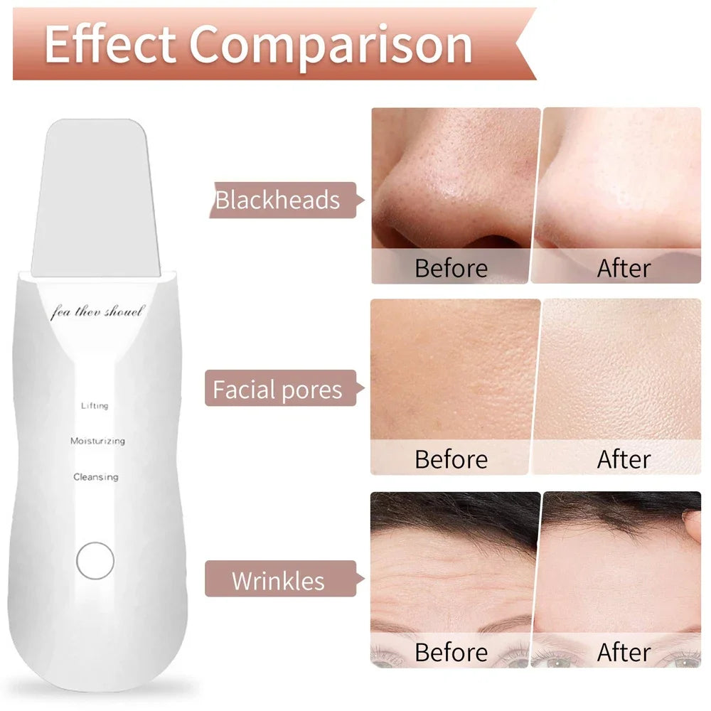 Electric Skin Scrubber Peeling Blackhead Remover