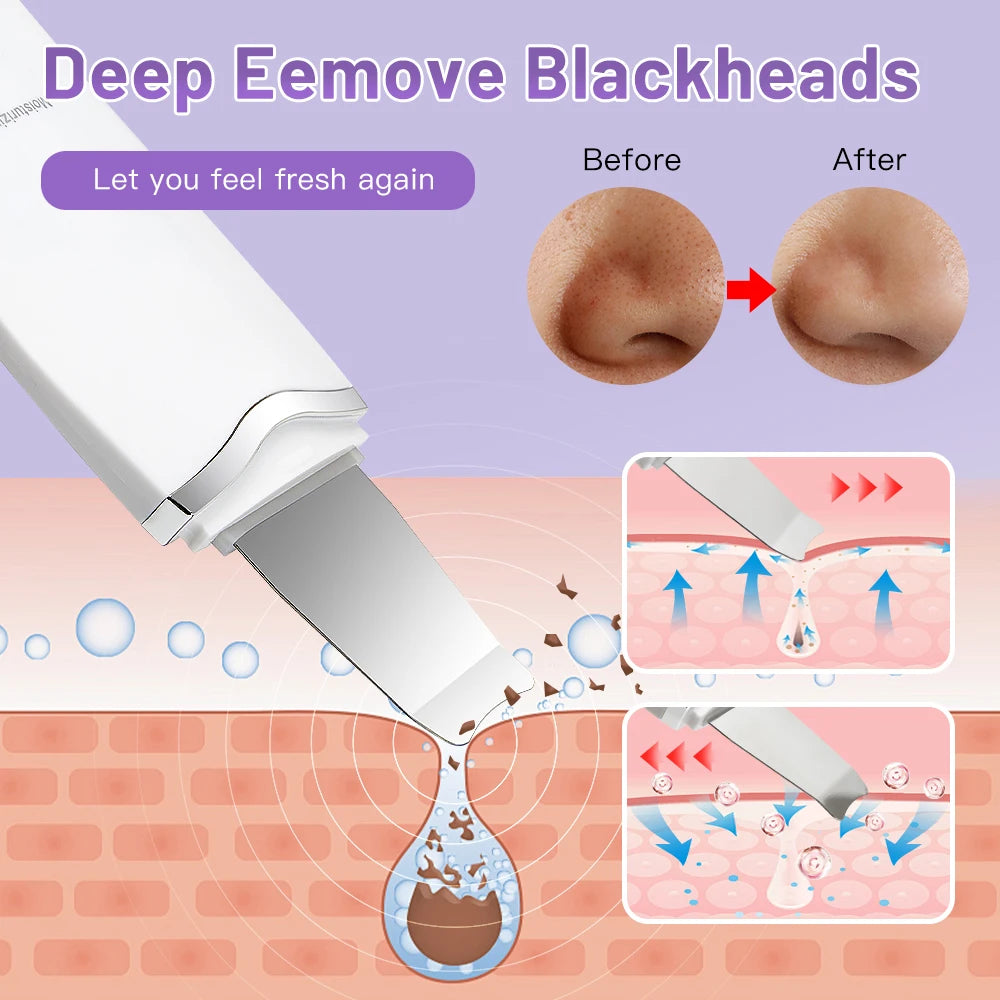 Electric Skin Scrubber Peeling Blackhead Remover