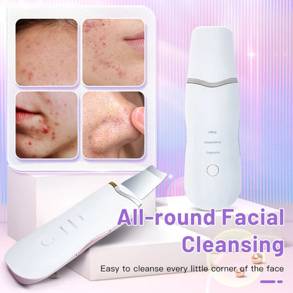 Electric Skin Scrubber Peeling Blackhead Remover
